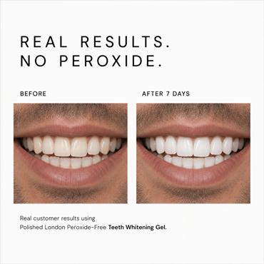 Polished London Teeth Whitening Gel Refills - 3 x 5ml