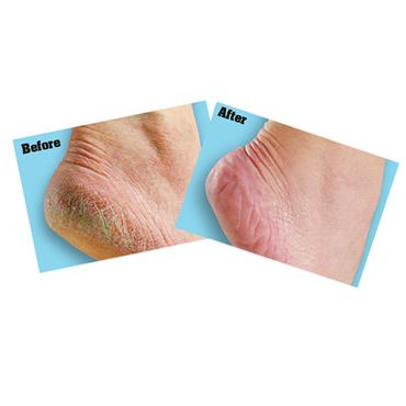 O'Keeffe's Healthy Feet Foot Cream  85g Tube