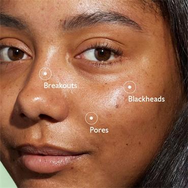 CAUDALIE BLEMISH CONTROL SALICYLIC SERUM 30ML