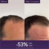 ANTI HAIR LOSS SERUM 50ML