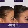 ANTI HAIR LOSS SERUM 50ML