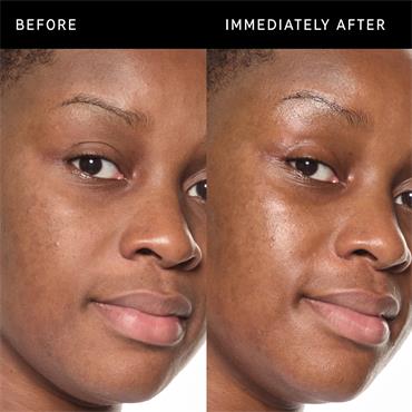 ECTOIN HYDRO-BARRIER SERUM