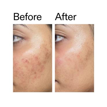 ECTOIN HYDRO-BARRIER SERUM 30ML