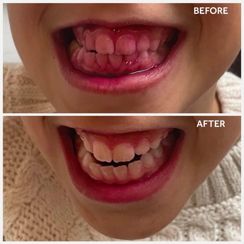 SPOTLIGHT KIDS PLAQUE DISCLOSING TABLETS CH Tralee Ireland