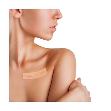 DERAMED SILICONE SHEET FOR SCAR TREATMENT