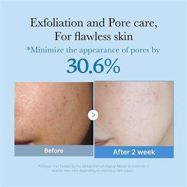 MEDICUBE ZERO PORE TONER 250ML