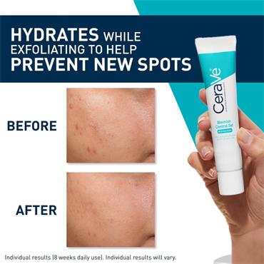 Cerave Blemish Control Gel