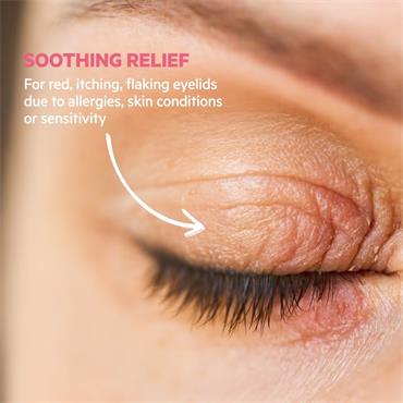 SVR Soothing Cream Ant-Itching Irritated Eyelids