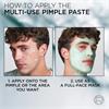Loreal Men Expert SOS Pimple Paste