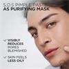 Loreal Men Expert SOS Pimple Paste