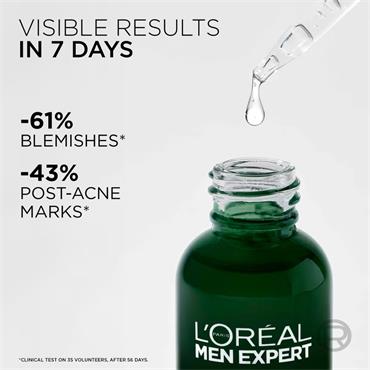 Loreal Men Expert Derma Control Serum