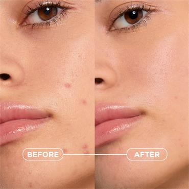 Bioderma Sebium Kerato+ 30ml