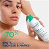 Bioderma Sebium Kerato+ Body Acne Spray for Body Spots, Redness and Post-Acne Marks 150ml