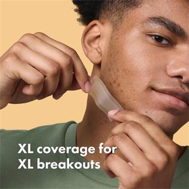 Hero Mighty Patch Surface