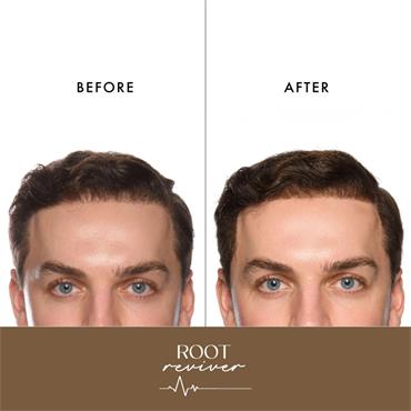 Voduz Root Reviver