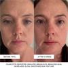 Beautypro Photon LED mask