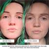 Beautypro Photon LED mask