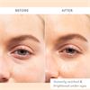 Patchology Soothing Eye Gels