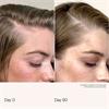 Living Proof Scalp Care Density Serum 50ml