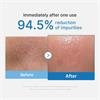 Medicube Pore Blackhead Cleansing Oil