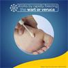 Scholl Verruca And Wart Freezse Remover