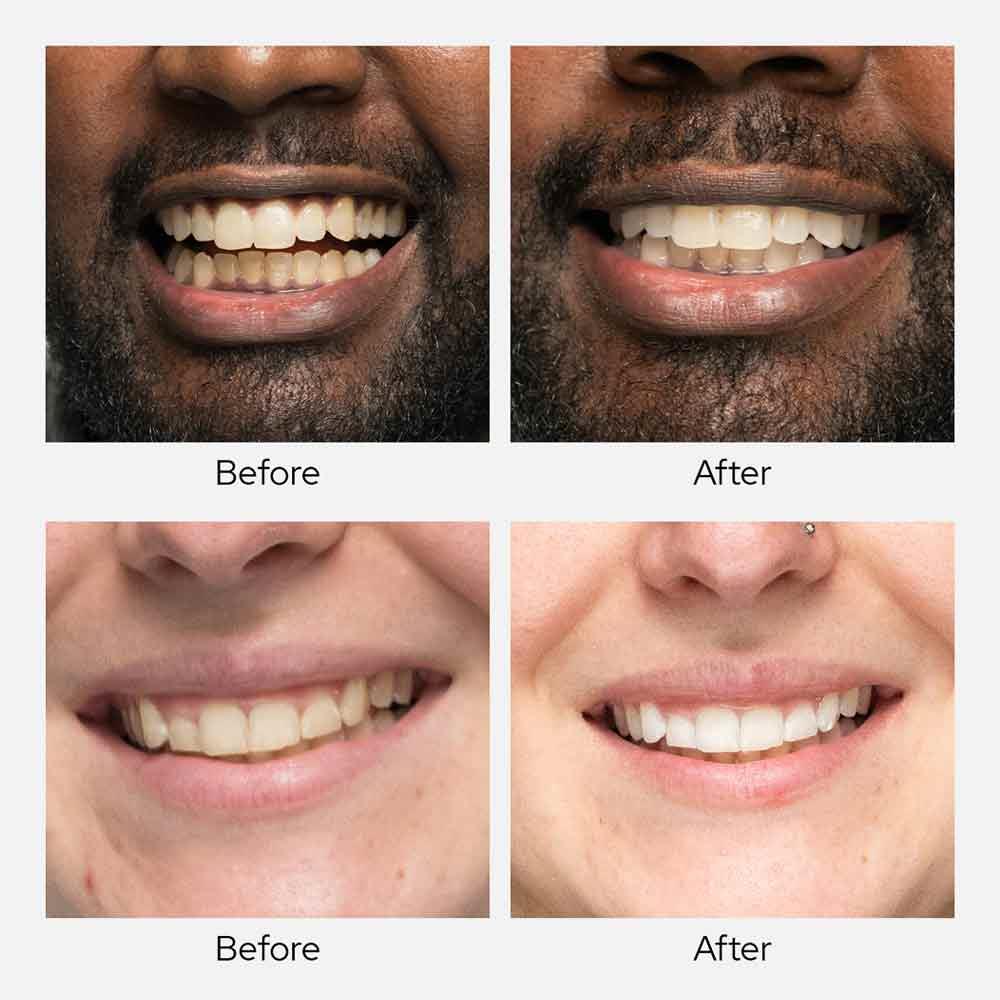 Spotlight Oral Care Teeth Whitening Powder With Diamond PAP+ Inish