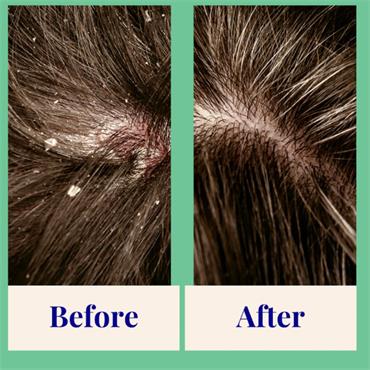 Exfoliating & Balancing Powder Shampoo 